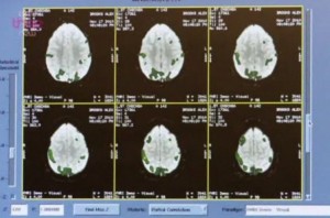 Apple scatena reazioni religiose nel cervello dei fan