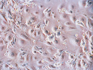 Cellule di anziani riprogrammate a stadio embrionale