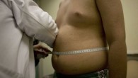 Essere sovrappeso abbassa il rischio di demenza senile