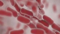 Allarme Usa: una misteriosa infezione sanguigna preoccupa gli Stati Uniti