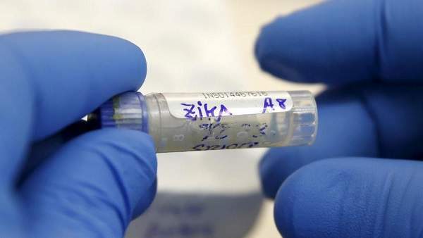 Usa, contagio virus Zika tra familiari: via di trasmissione diversa da quelle già note