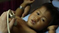 Birmania, 30 bambini morti e altri ricoverati: ancora giallo sulle cause