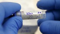 Virus Zika, si moltiplicano i casi in Italia: si passa da 31 a 61 in poche settimane