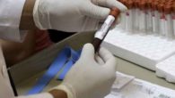 Virus Zika, registrati i primi tre casi di infezione in India. Allerta anche per gli italiani