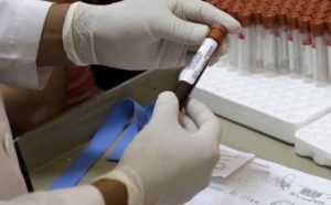 Virus Zika, registrati i primi tre casi di infezione in India. Allerta anche per gli italiani